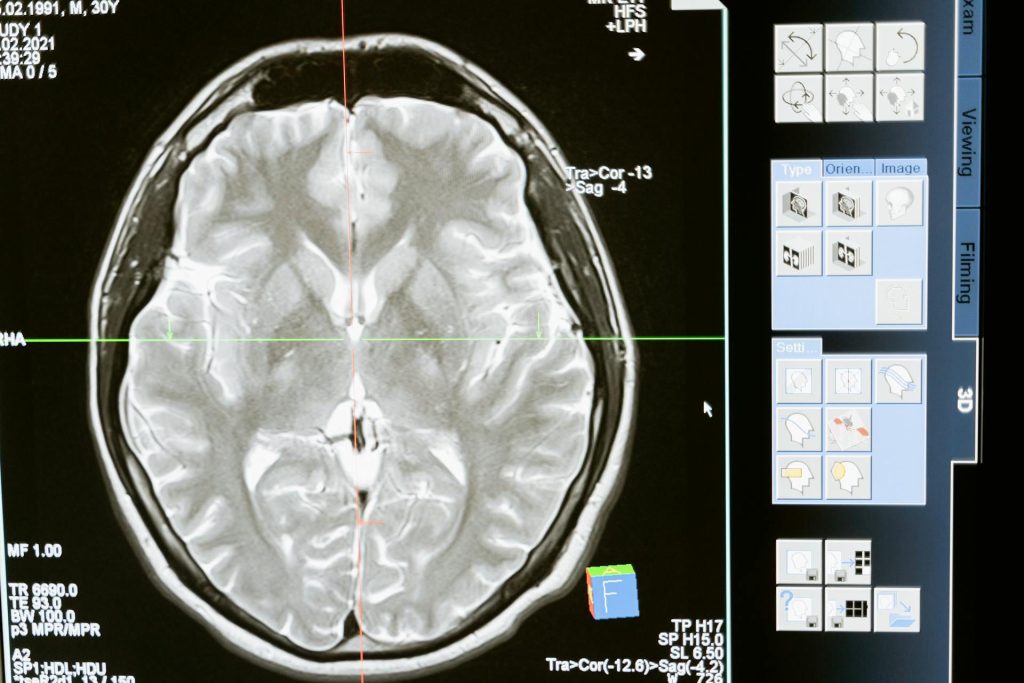Un viaggio nel cervello: alla scoperta dell’encefalo umano e ovino
